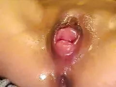 Trong cái mông phim sex hoc sinh phu de bị ung thư